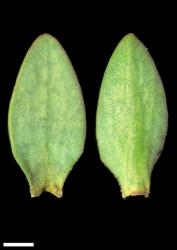 Veronica pimeleoides subsp. pimeleoides. Leaf surfaces, adaxial (left) and abaxial (right). Scale = 1 mm.
 Image: W.M. Malcolm © Te Papa CC-BY-NC 3.0 NZ